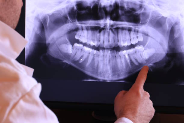 Best Urgent Care for Lost Fillings or Crowns in Merced, CA