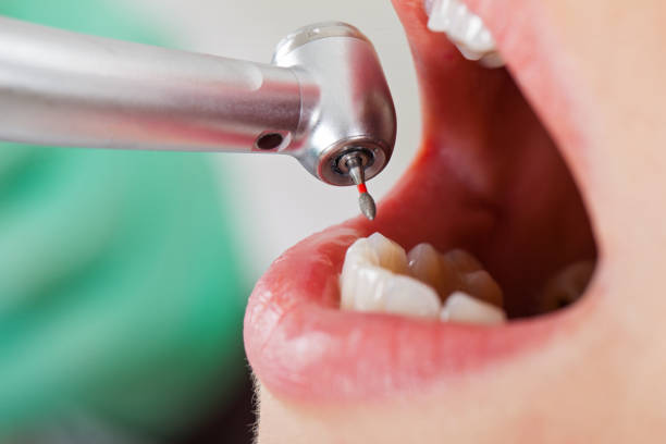 Best Pediatric Emergency Dentist in Merced, CA